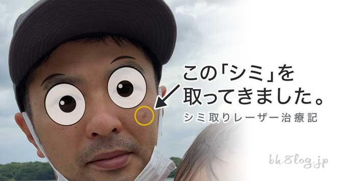アイキャッチ|【男性向けシミ取りレーザーのレビュー】湘南美容に行ってきました!