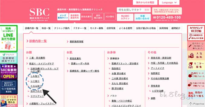 湘南美容（SBC）｜診療内容一覧からシミ取りをクリック