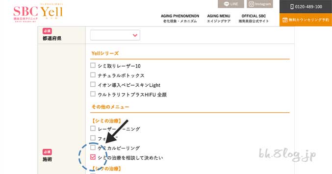 湘南美容（SBC）｜シミの治療を相談して決めたいにチェック